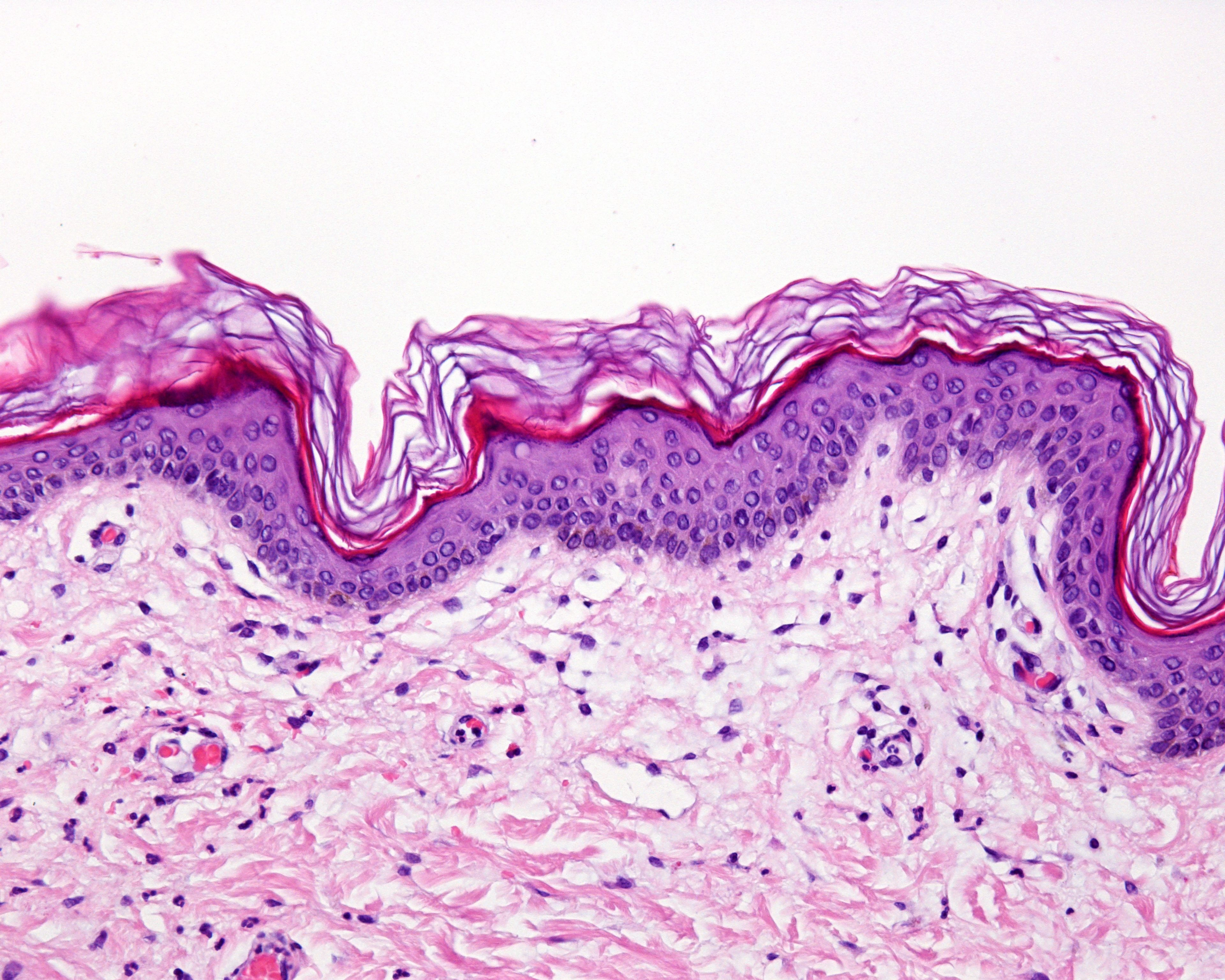 Skin Histology Diagram